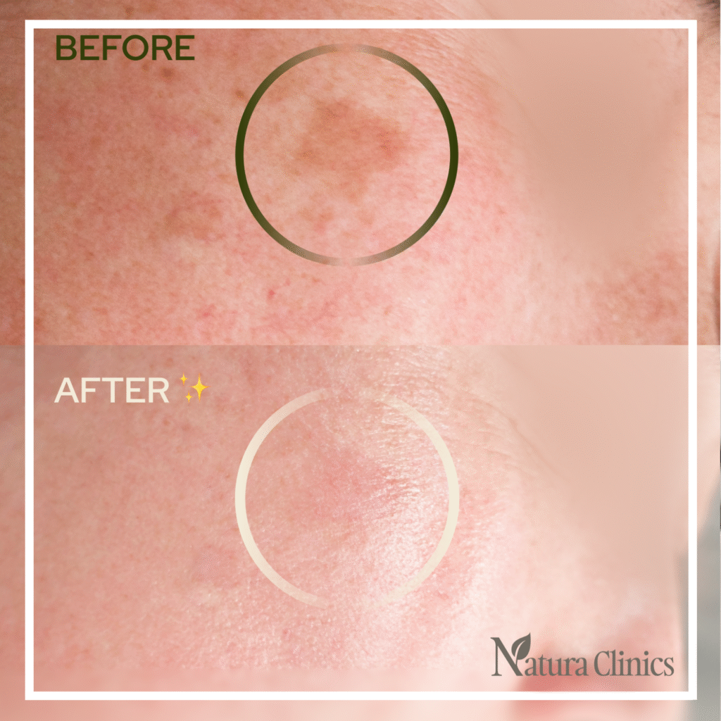 Natura Clinics | Facial & Cosmetics