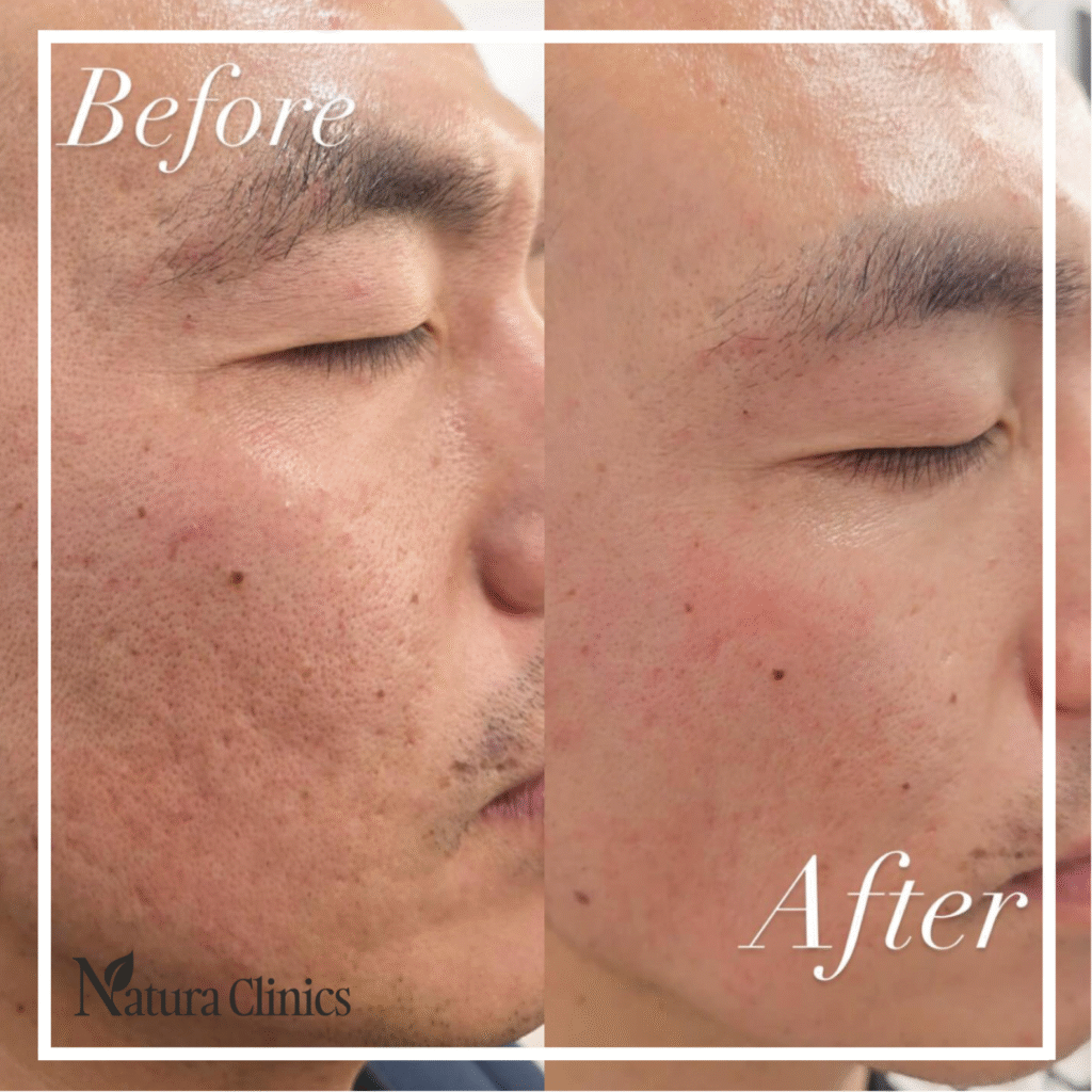 Natura Clinics | Hair Loss Solution